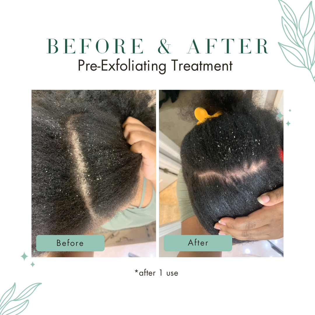 REFILL | Pre-Exfoliating Scalp Treatment System