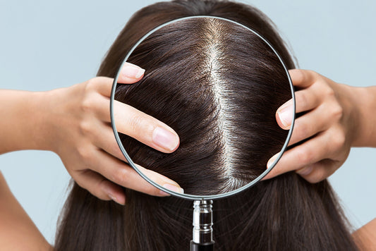 Beneath the Surface: The Critical Impact of Scalp Health