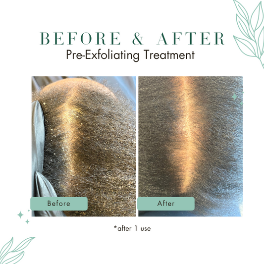 Scalp Prep System™ | 4oz.