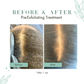 Pre-Exfoliating Scalp Treatment + Exfoliation Comb