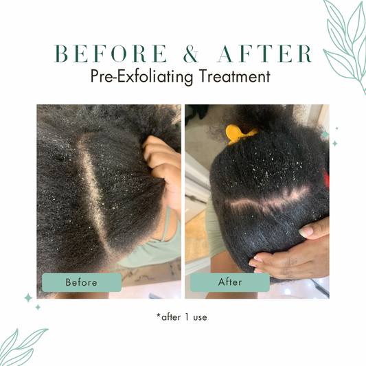 Scalp Prep System™ | 2 oz.