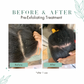 REFILL | Pre-Exfoliating Scalp Treatment System