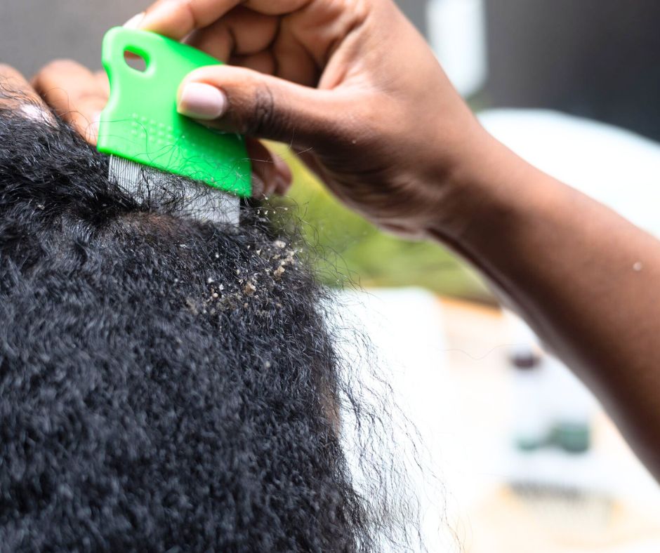 REFILL | Pre-Exfoliating Scalp Treatment System